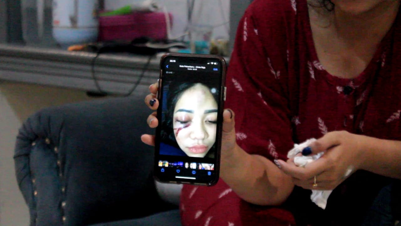 Terkait Dugaan Penganiayaan Pacar, Polresta Pekanbaru Bakal Lakukan Pemanggilan RR