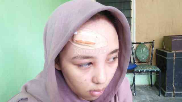 Dramatis! Salma Nabila Korban Penyekapan di Kemayoran Banyak Sayatan pada Tangan