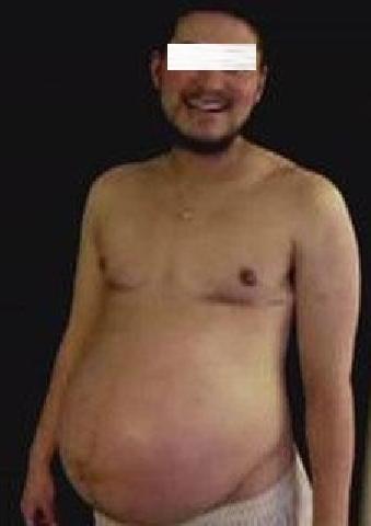 Pria Berjenggot Ini Hamil dan Melahirkan