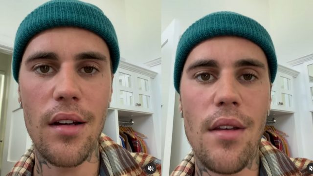 Diserang Sindrom Ramsay Hunt, Sebelah Wajah Justin Bieber Lumpuh Total