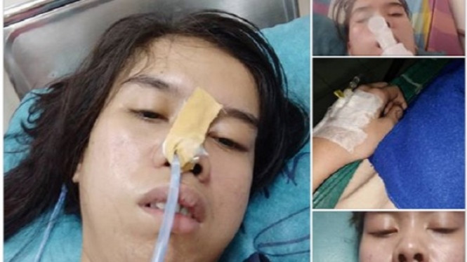 Viral, Wanita Ini Kena Stroke Akibat Kecanduan Main ML