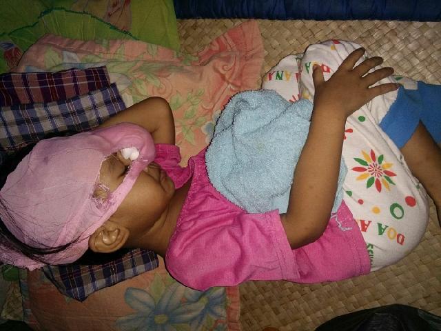 Polres Rohil Jenguk bocah pengidap kanker mata