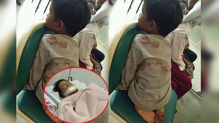 Saat Dibacok Suami Hingga Tewas, Diduga Sumarni Tengah Gendong Bayinya, Begini Kondisi Sang Anak