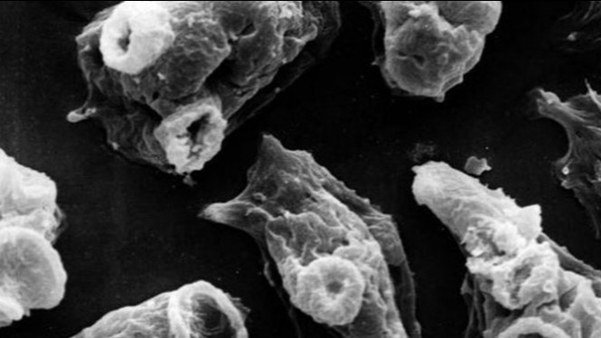 10 Benda Mengerikan yang Ditemukan dalam Tubuh Manusia