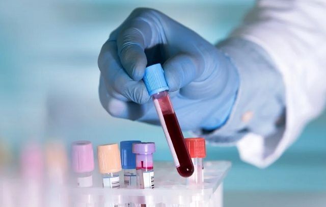 Alat Rapid Test China Bikin Orang Negatif Jadi Positif Corona