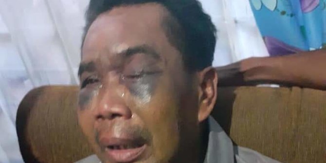 Pilunya Si Abang Kuli Bangunan Ini, Jadi Saksi Pembunuhan Malah Babak Belur Dipukuli