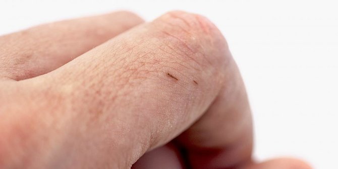 Berbahaya! Ketahui Dampak Jika Serpihan Kayu atau Tlusupan Tidak Segera Diatasi