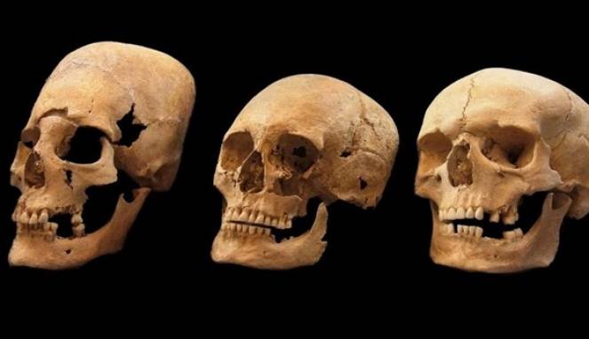 Misteri Temuan Tengkorak Aneh yang Memanjang di Jerman