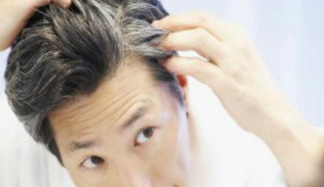 Tutupi Uban Tanpa Perlu Mengecat Rambut