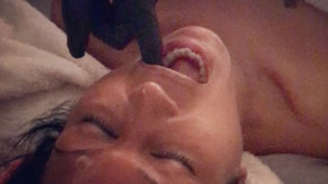 6 Tanda Penyakit Berbahaya Dilihat dari Kondisi Mulut