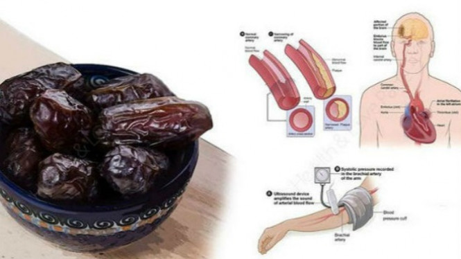 Buah Paling Menguntungkan untuk Stroke Hingga Hipertensi