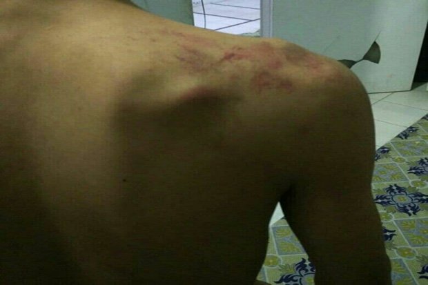 Dikira Merekam Balap Liar, Hengky Babak Belur Dikeroyok Geng Motor