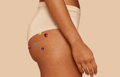 4 Bahan Alami Ini Ampuh Hilangkan Jerawat di Bokong