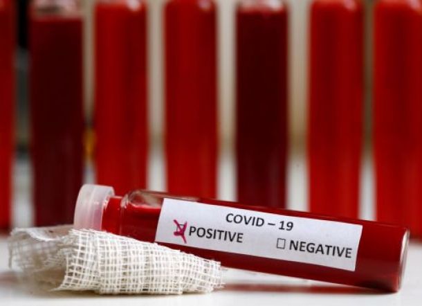 Hasil Penelitian Terbaru, Virus Corona Bisa Bertahan Berjam-jam di Permukaan Benda