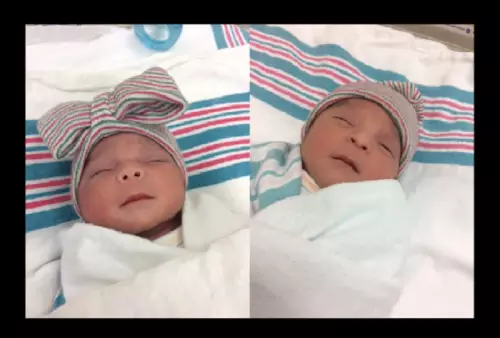 Unik, Bayi Kembar Ini Lahir di Tahun yang Berbeda!