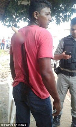 Ditusuk Orang Tak Dikenal, Orang Ini Tetap Tenang Menunggu Ambulans