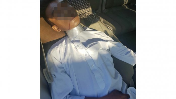 Selain Jasad Korban, Dalam Mobil di Parkiran Bandara SSK II Juga Ditemukan Botol Berisi Cairan Ini