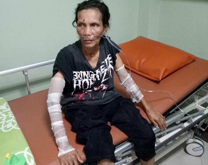 Api Kompor Gas Membesar, Ibu Rumah Tangga di Pekanbaru ini Nyaris Hangus Terbakar