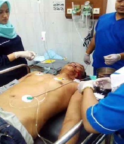 Cemburu Buta, Seorang Pria di Pekanbaru cutter Muka Mantan Suami Istrinya