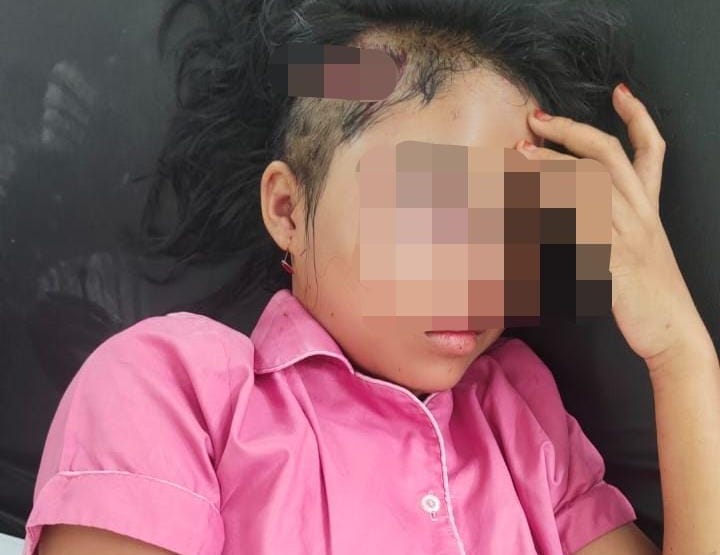 Remaja 15 Tahun Jadi Korban Penganiayaan Pengemudi Kapal Pompong di Indragiri Hilir