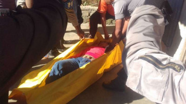 Bunuh Diri karena Frustrasi Tak Pernah Tumbuh Rambut