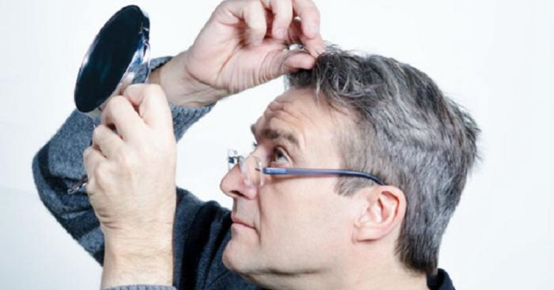 Emosi Penyebab Tumbuhnya Uban, Ini Penjelasannya