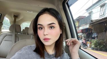 Selebgram Edelenyi Laura Alias Laura Anna Meninggal Dunia