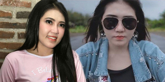 Inilah Penyebab Via Vallen Tiba-tiba Ambruk di Atas Panggung Saat Nyanyi 'Pamer Bojo'