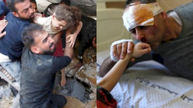 Gadis di Gaza Berhasil Selamat Setelah Dihantam Rudal Israel, Ibu dan 4 Saudaranya Tewas