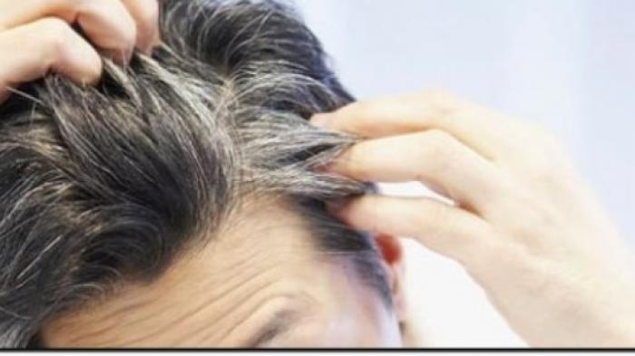Penyebab Tumbuhnya Uban di Rambut karena Emosi