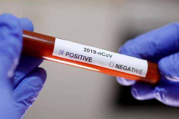 Pantas Vietnam Bisa Nol Kasus Positif Covid-19 Selama 8 Hari Berturut-Turut, Ini Rahasianya