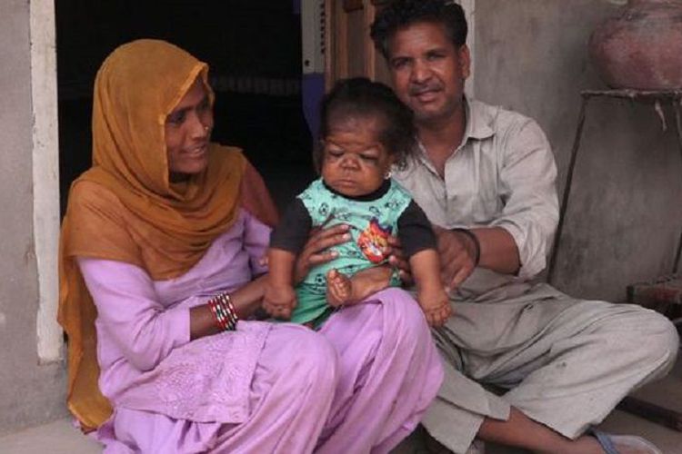 Meski Berusia 23 Tahun, Pria Ini Bertubuh Layaknya Balita