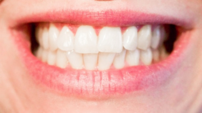 Gigi Menguning Gara-gara Sering Minum Kopi, Ini Solusinya