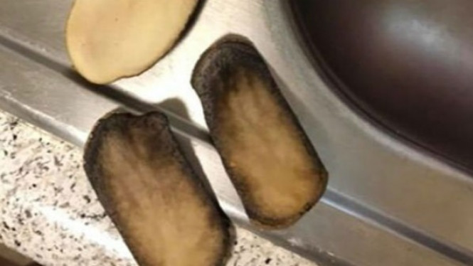 Sembuhkan Batuk dengan Menyimpan Kentang di Kaus Kaki