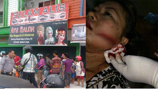 Pemilik Salon di Pasir Putih, Kampar Wajah dan Perutnya Dibacok Pelanggan