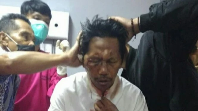 Waduh! Imam Masjid di Garut Dianiaya Orang Tak Dikenal