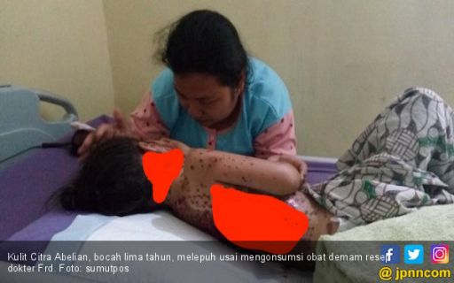 Kasihan! Tubuh Bocah Ini Melepuh Usai Minum Obat Resep Dokter