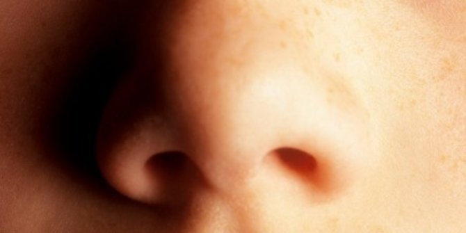 Ini Penyebab Munculnya Jerawat di Dalam Hidung dan Cara Mengatasinya