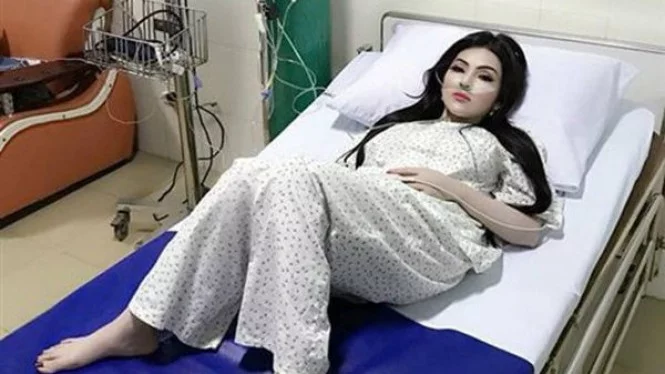 Dirawat di RS Wanita Ini Pakai Make Up Tebal Karena Mau Dijenguk Pacar