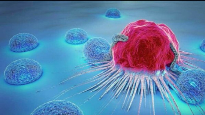 10 Tanda Kemungkinan Seseorang Telah Terkena Kanker