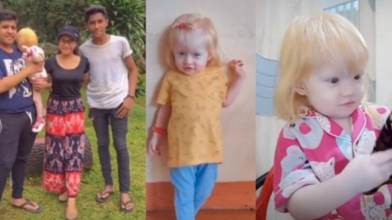 Bukan Albino, Bocah di NTT Ini Beda dari Saudaranya yang Lain