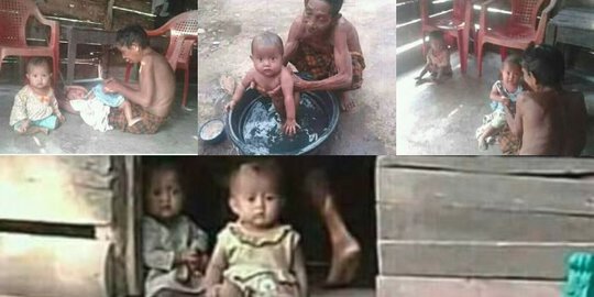 Pilu, Kondisi Memprihatinkan Balita Kembar Rana dan Rani yang Ibunya Meninggal Saat Melahirkan