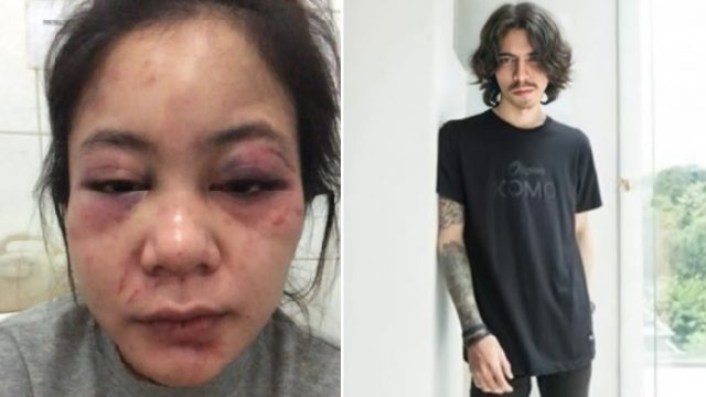 Bule Terduga Pelaku KDRT Ternyata Pernah Dihukum Ridwan Kamil