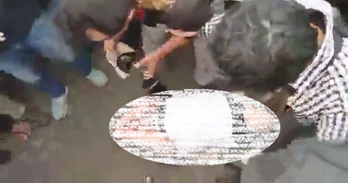 Ade Armando Dianiaya depan Gedung DPR RI, Kombes Endra Zulpan: Lukanya Cukup Parah