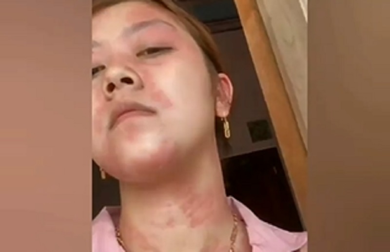 Ini Deretan Orang yang Dilarang Keras Suntik Putih, Siapa Saja?