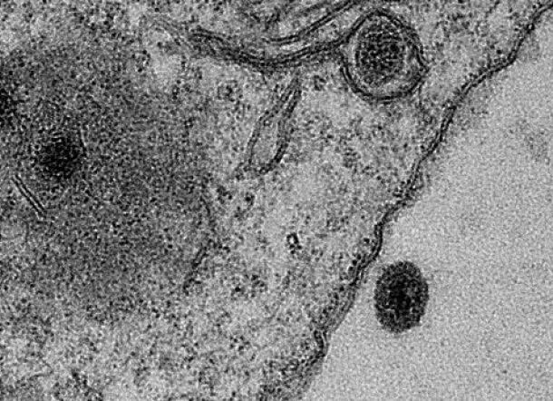 Wah! Ada Virus Misterius di Brazil, Ilmuan Bingung karena 90% Baru