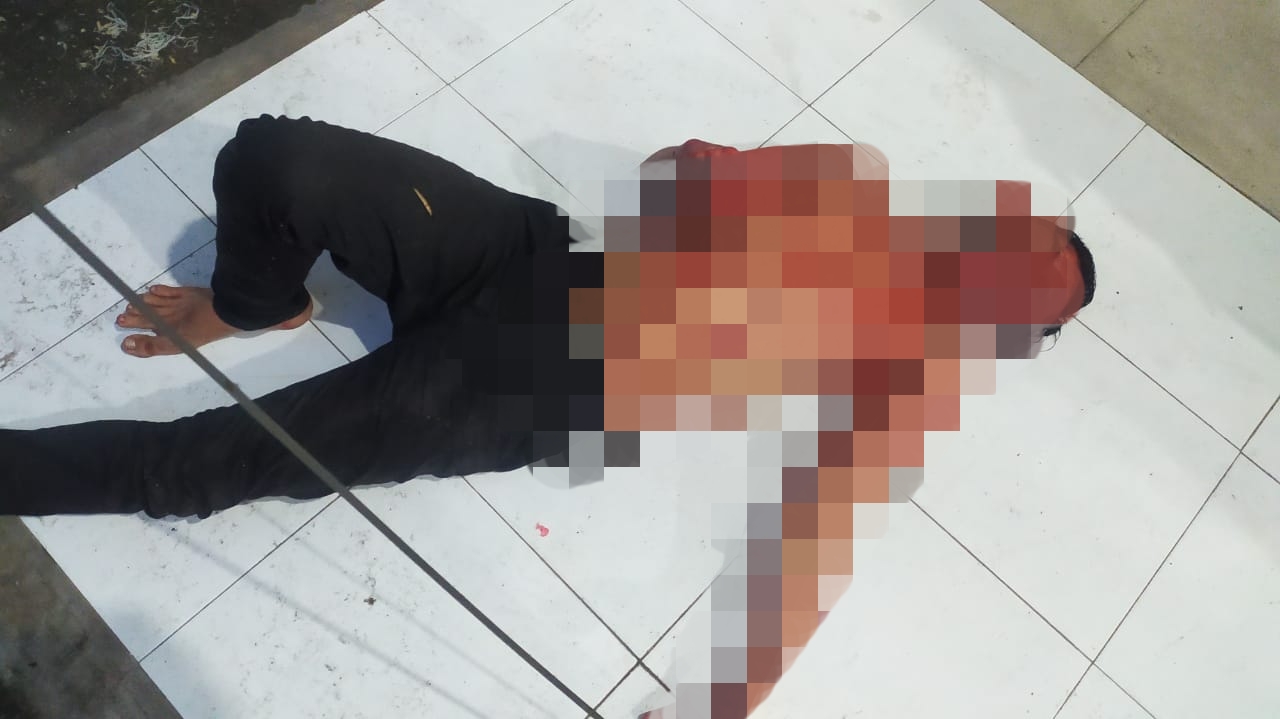 Sakit Hati Berujung Penganiayaan, Karyawan Kedai Kopi di Pekanbaru Alami Luka Tusuk