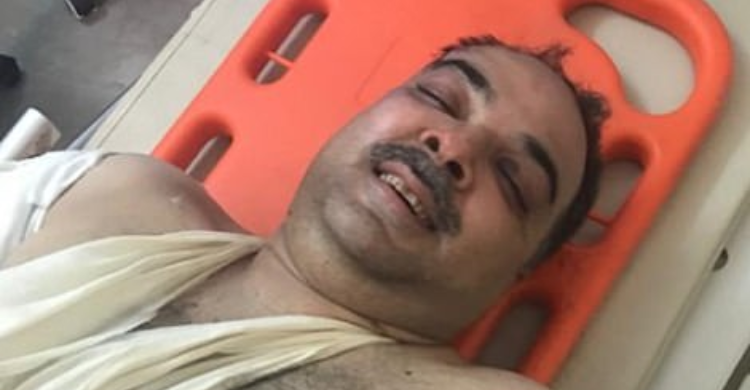 Ajaib, 2 Orang Selamat Dari Kecelakaan Pesawat Di Pakistan