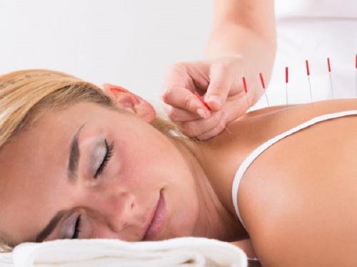 Terapi Akupunktur Ternyata Bisa Atasi Insomnia pada Pasien Kanker