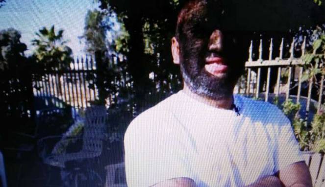 Tubuh dan Wajah Dipenuhi Rambut, Pria Ini Disebut 'Wolf Man'